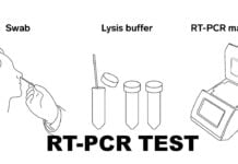 RT-PCR Test